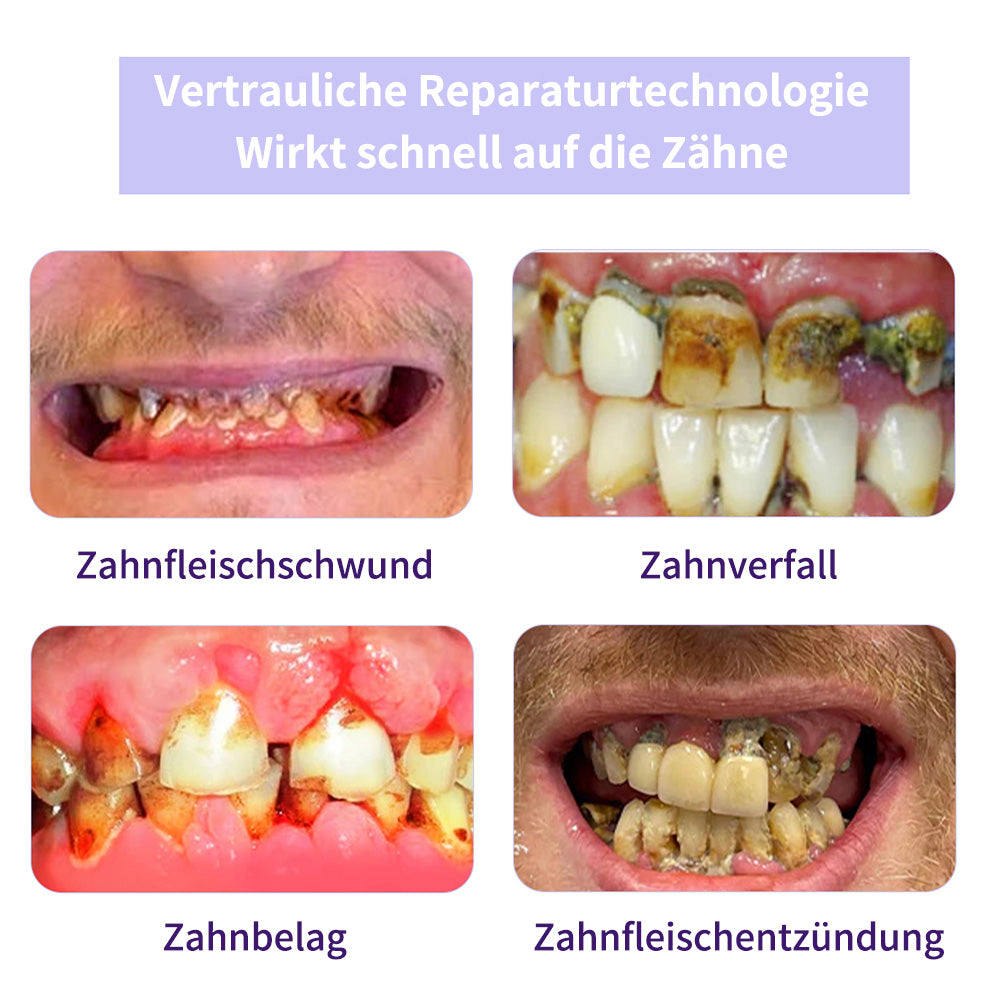 🔥4 Dosen(✨Konsolidierungstherapie✨）